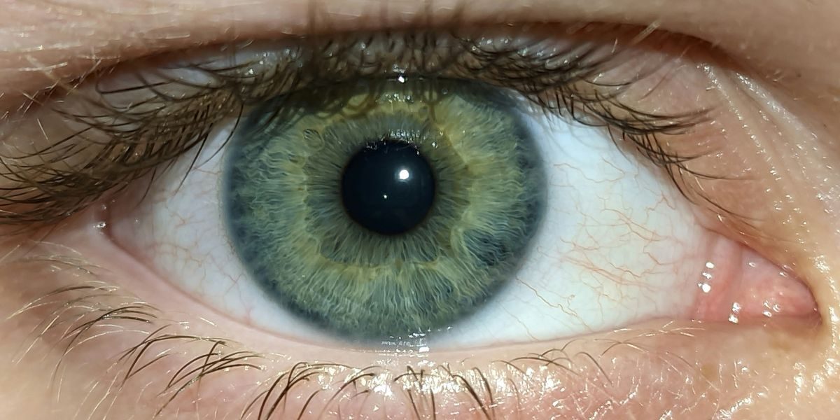 When to Visit Ocular Aesthetics in Melbourne
