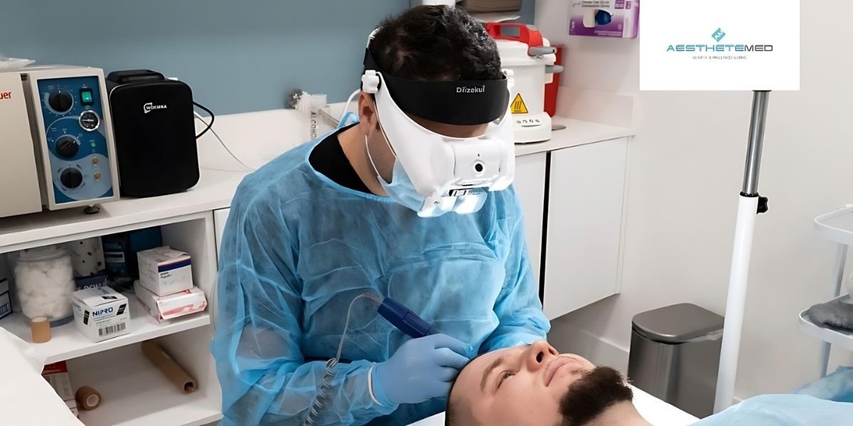 Hair Transplant in the USA: Why Patients Choose AestheteMed in Florida