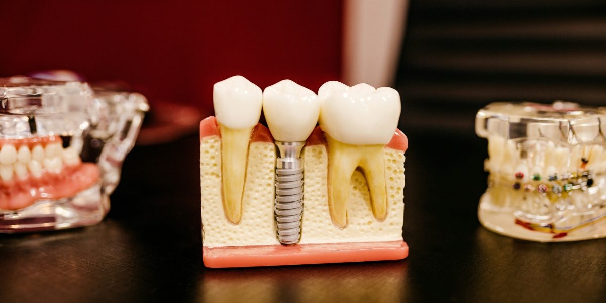 A Patient's Guide to Choosing the Right Dental Group in Greenvale