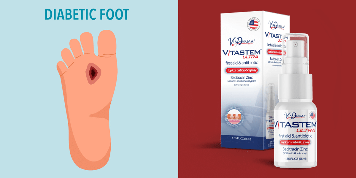 Vitastem Ultra: A New & Innovative Topical Antibiotic That Can Help 2 Million US Diabetic Foot Ulcer Suffers Heal 10x Better