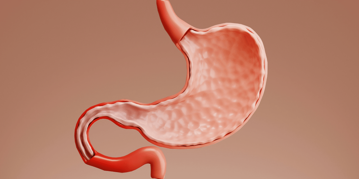 Is Gastric Sleeve Tightening Possible?