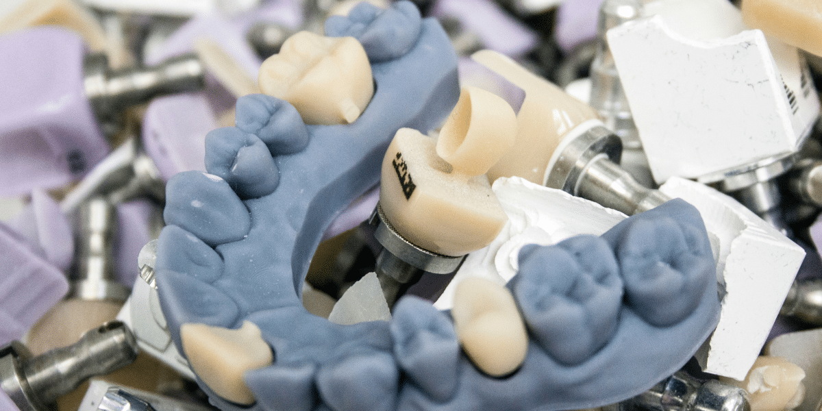 Protecting and Enhancing Your Teeth With Dental Crowns