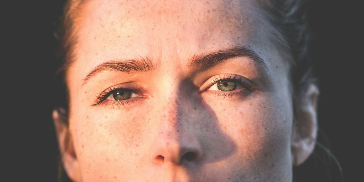 How to Treat Glabellar Lines: A Comprehensive Guide to Modern Treatments